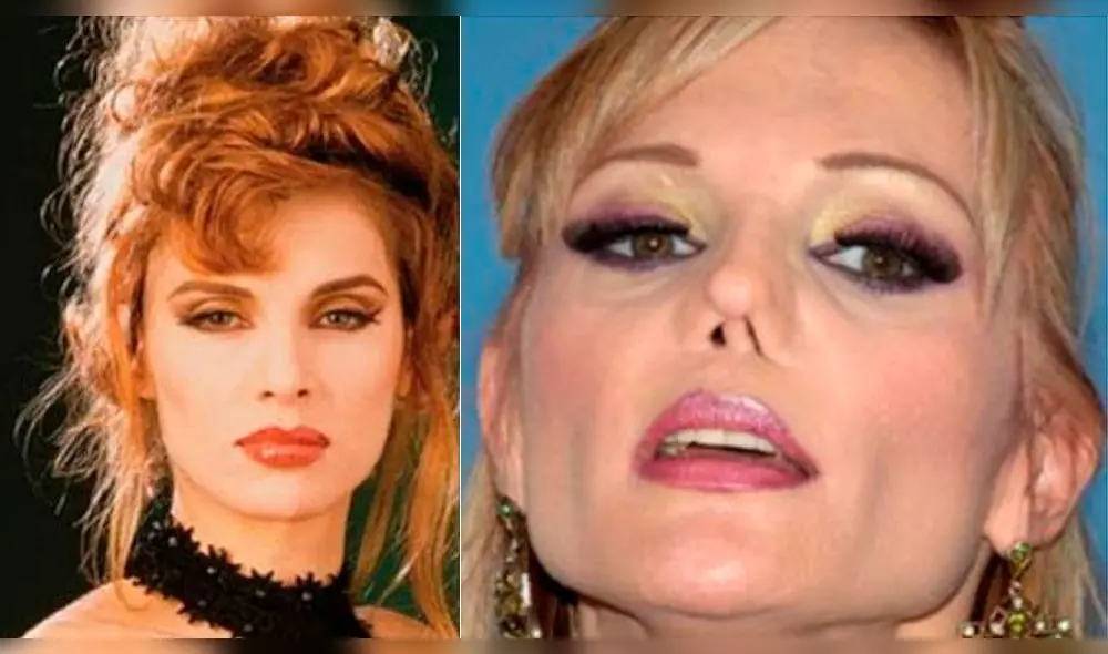 Lucía Méndez antes y después