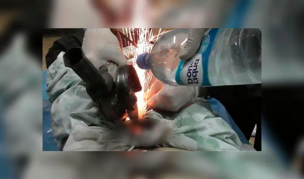 Colocó una tuerca en el miembro viril de su esposo como ‘castigo’ al enterarse que le fue infiel [VIDEO]