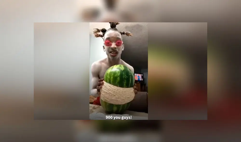 Desliza las imágenes para ver el terrible resultado que obtuvo un joven al hacer un experimento casero. Foto: VT Desliza las imágenes para ver el terrible resultado que obtuvo un joven al hacer un experimento casero. Foto: VT