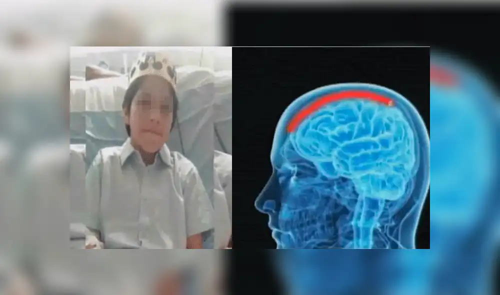 Piden ayuda para menor de 12 años que posee una extraña ameba en su cerebro [VIDEO]