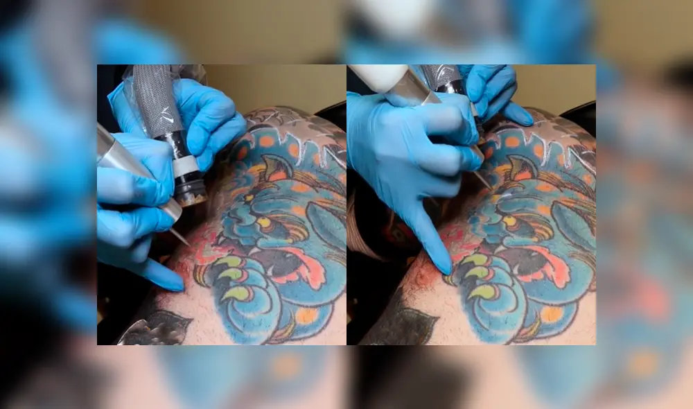 Facebook viral: joven intenta quitarse tatuaje del brazo, sin imaginar el terrible resultado que tendría