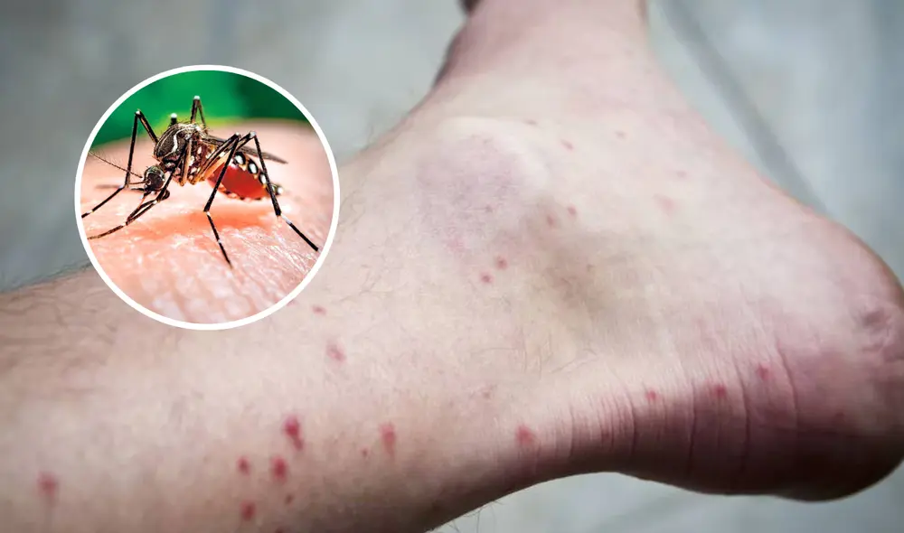 Los mosquitos suelen elegir a sus víctimas por el olor que estas desprenden. Foto: composición LR/AFP
