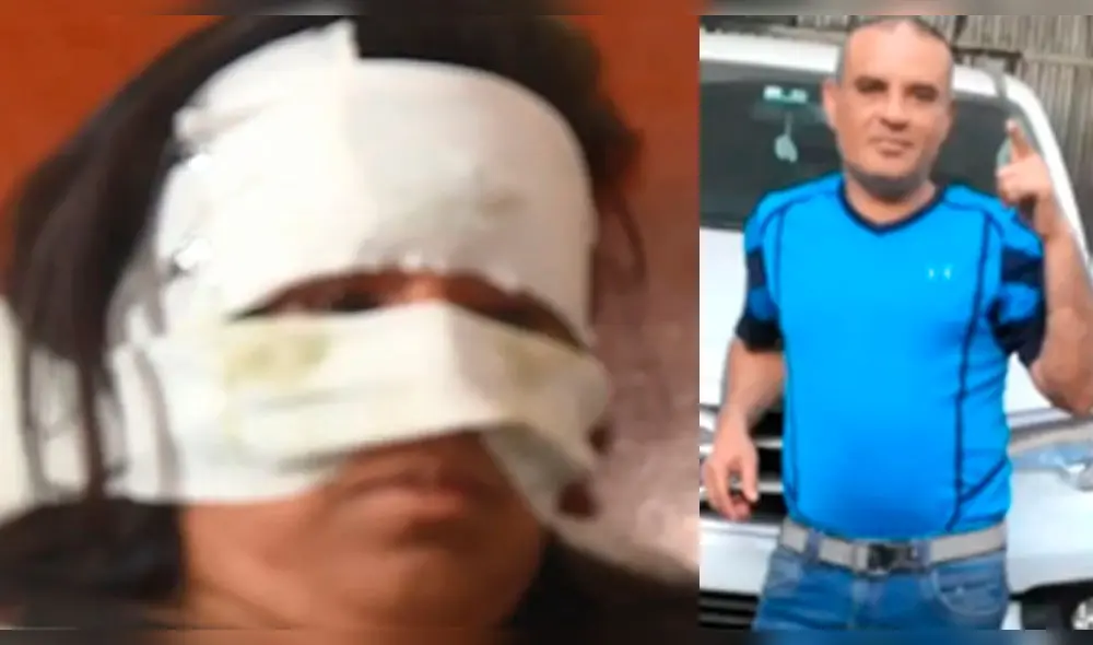 Ate: Extranjeros no quisieron pagar alquiler y acuchillaron brutalmente a dueña
