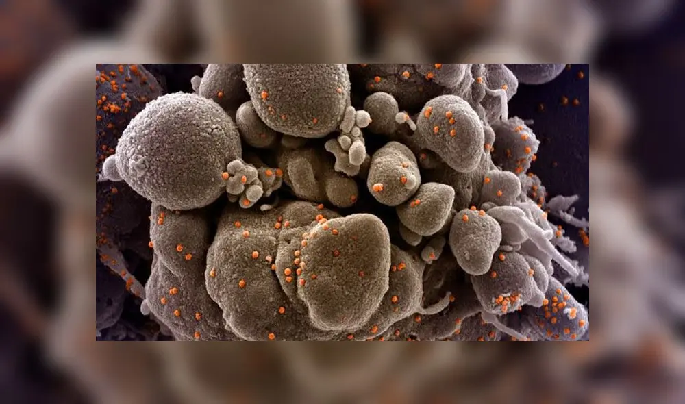 Impactantes imágenes del coronavirus atacando células humanas Impactantes imágenes del coronavirus atacando células humanas