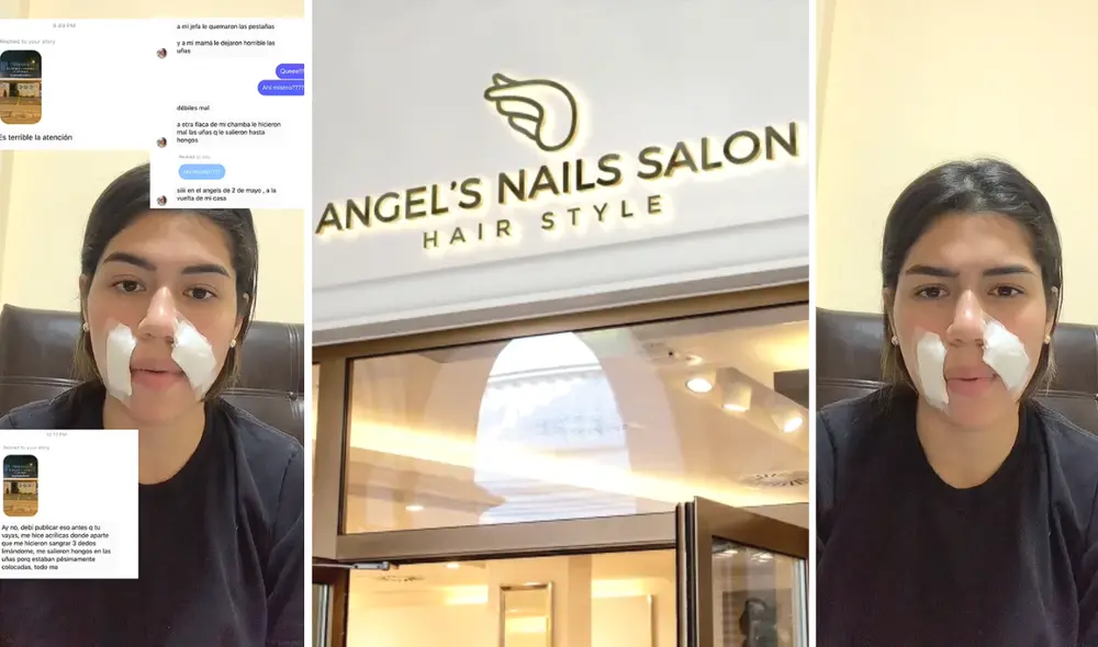 Denuncian mala praxis en peluquería Angel's Nails Salon por depilación con cera sobre rostro “Me quemaron la piel”. Foto: composición LR/capturas de Tik Tok/@Milagros Gallegos/Angel's Nails Salon Denuncian mala praxis en peluquería Angel's Nails Salon por depilación con cera sobre rostro “Me quemaron la piel”. Foto: composición LR/capturas de Tik Tok/@Milagros Gallegos/Angel's Nails Salon