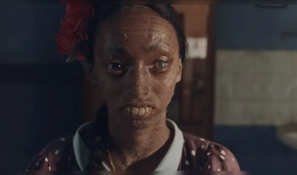 Nisha sufre de una de las afecciones cutáneas más raras del mundo. Foto: Captura.