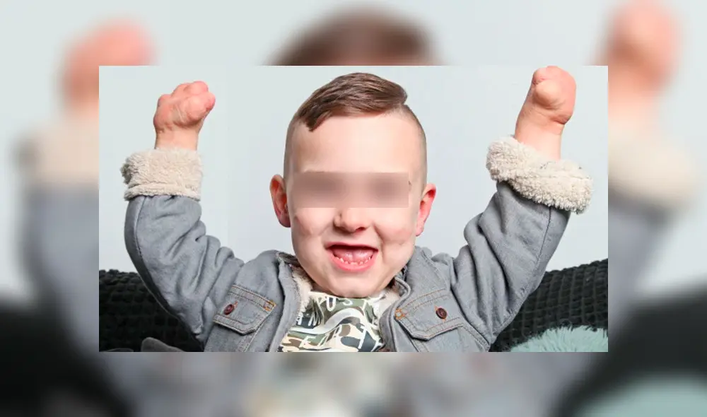 Cuatro años después, el menor pudo salir adelante y continuar con una vida normal. (Foto: The SUn) Cuatro años después, el menor pudo salir adelante y continuar con una vida normal. (Foto: The SUn)