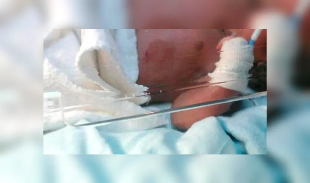 Bebé de 8 meses víctima de maltrato infantil termina con el brazo fracturado