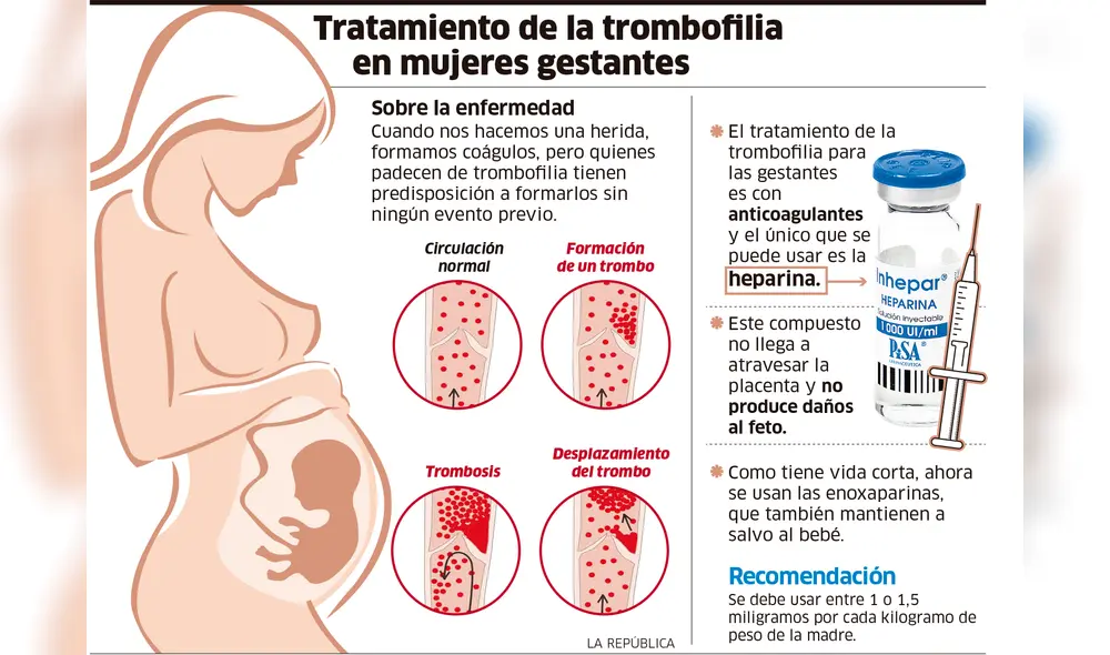 Tratamiento de las trombofilia en mujeres gestantes [INFOGRAFÍA]