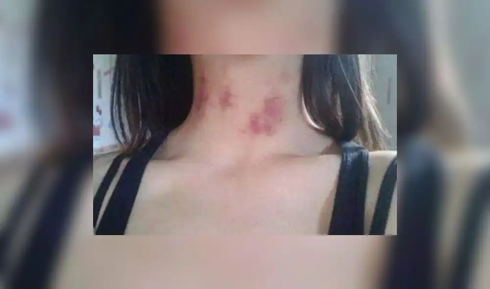 En Facebook, pidió que ayuden a su novia pero usuarios le mostraron una cruda verdad