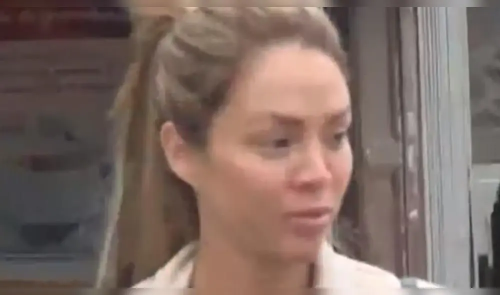 Sheyla Rojas sufre transformación en su rostro tras viaje con millonario Sheyla Rojas sufre transformación en su rostro tras viaje con millonario