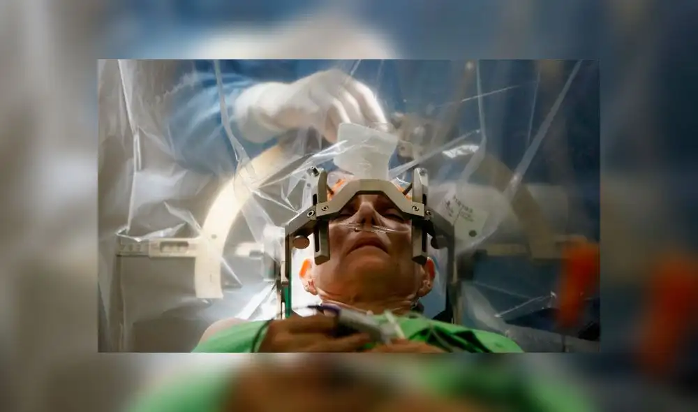 Las muestras vivas de cerebro son obtenidas de pacientes que se someten a neurocirugías para tratar la epilepsia o tumores. Foto referencial: Sinirbilim.