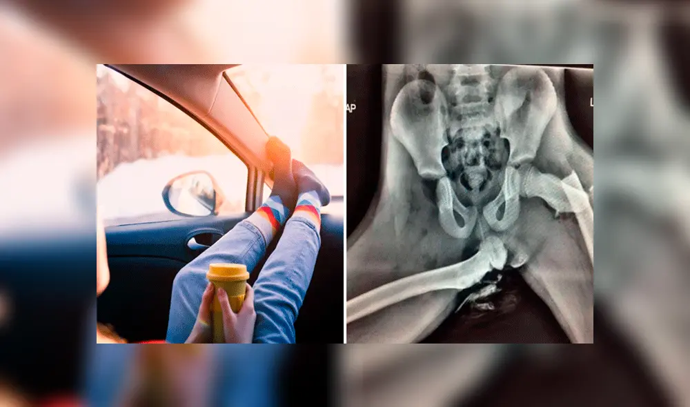 Mujer sufrió terribles fracturas por negligencia propia. Mujer sufrió terribles fracturas por negligencia propia.