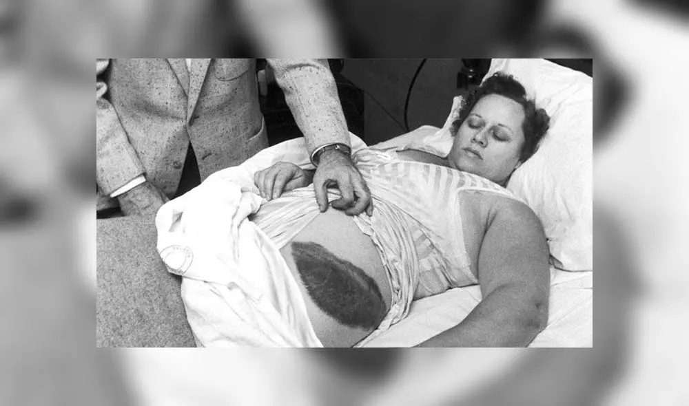 El meteorito impactó en una de las caderas de Ann Hodges. Foto: Jay Leviton/LIFE. El meteorito impactó en una de las caderas de Ann Hodges. Foto: Jay Leviton/LIFE.