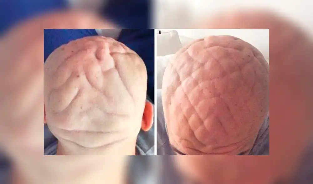 El extraño caso del hombre con la cabeza en forma de cerebro