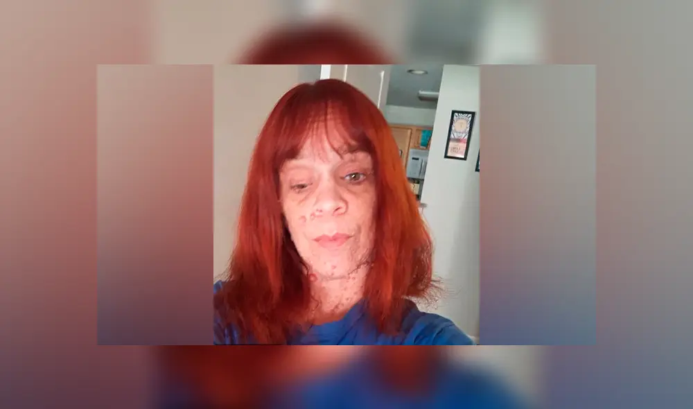 Mujer cubierta de más de 2.000 tumores revela que es abusada por extraños en la calle [FOTOS]