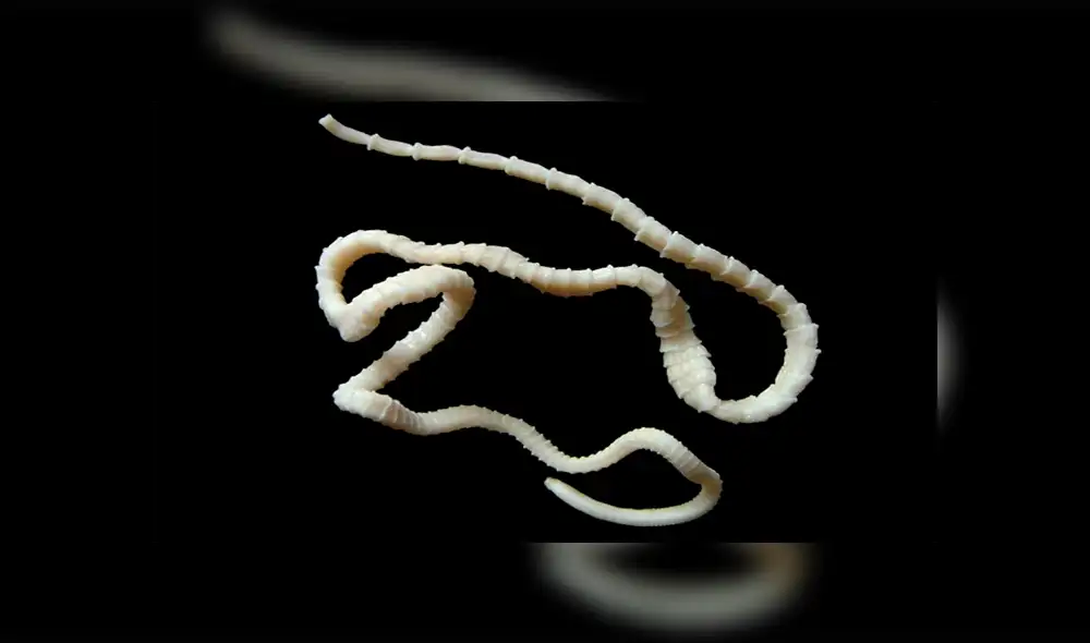 El hombre tuvo el parásito en su cabeza por casi una década. Fuente: foto referencial.