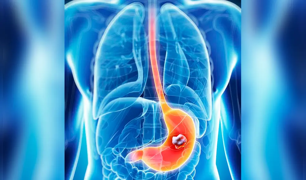 Las sedes de la Liga Contra el Cáncer se encuentran ubicadas en Pueblo Libre, Lima y Surquillo.