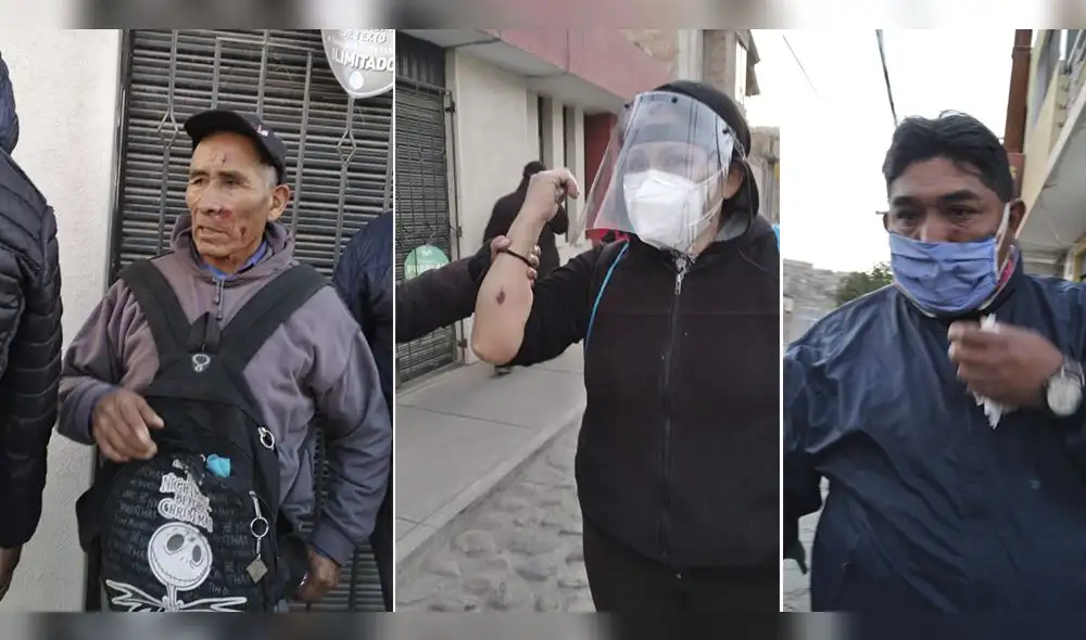 Trabajadores de la municipalidad de Paucarpata resultaron heridos, tras ser reprimidos por la Policía Nacional. Trabajadores de la municipalidad de Paucarpata resultaron heridos, tras ser reprimidos por la Policía Nacional.