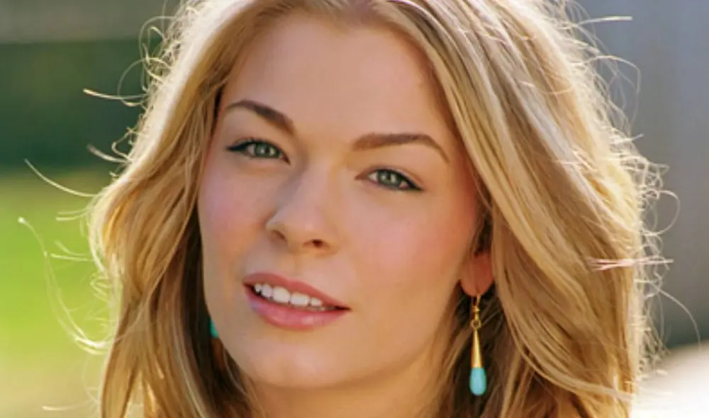 La cantante siempre se ha mostrado abierta para hablar acerca de su condición. Foto: difusión