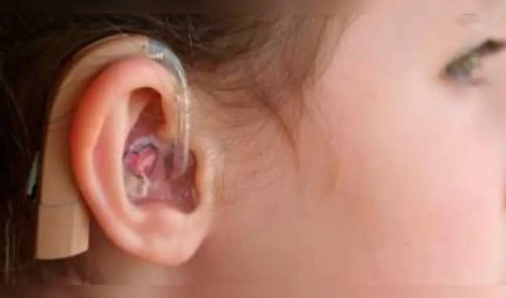 Rotary Club entregará mil audífonos a niños con problemas auditivos en Arequipa