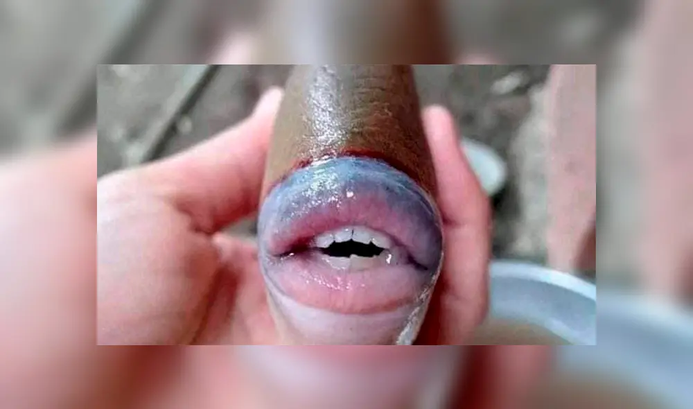 Imágenes de un pez con dientes y labios muy parecidos al de los humanos se hicieron virales en redes sociales. (Foto: Twitter @raff_nasir) Imágenes de un pez con dientes y labios muy parecidos al de los humanos se hicieron virales en redes sociales. (Foto: Twitter @raff_nasir)