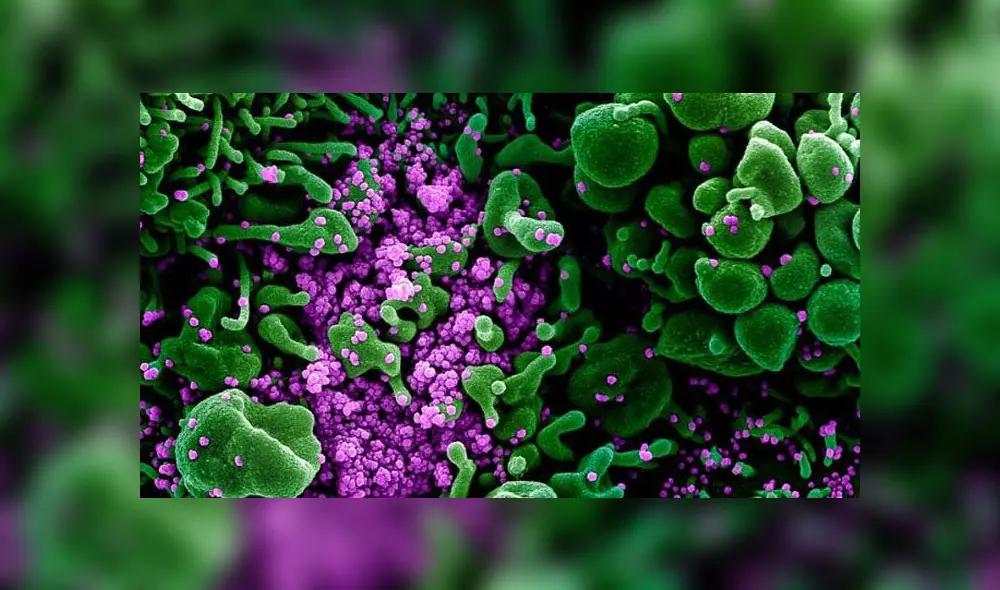 Impactantes imágenes del coronavirus atacando células humanas Impactantes imágenes del coronavirus atacando células humanas