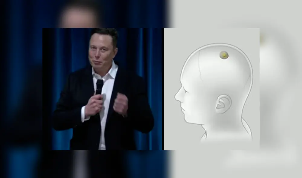 Elon Musk durante la presentación de los chips desarrollados por Neuralink. Foto: Captura: Neuralink Update