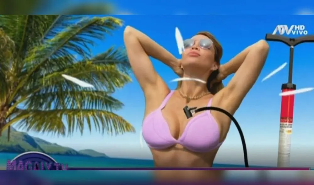 Médico advierte que implantes de Sheyla Rojas podrían caerse. Foto: Captura.