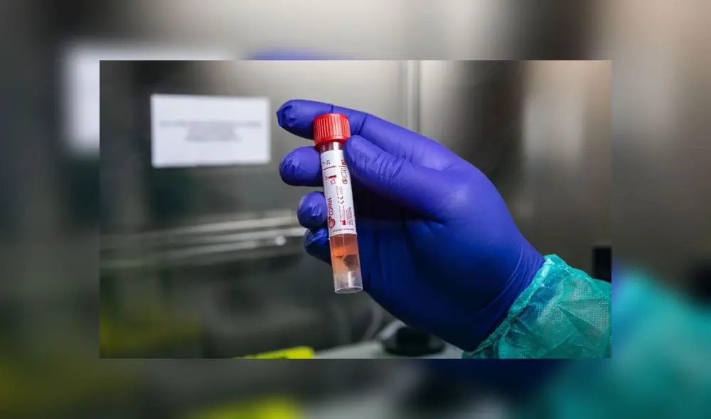 Muestra de prueba rápida de coronavirus. Foto: Difusión. Muestra de prueba rápida de coronavirus. Foto: Difusión.