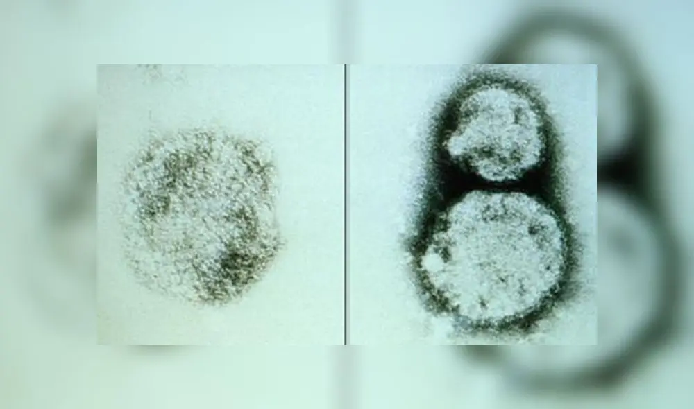 El hantavirus puede ser mortal, según la OMS. Foto: BBC. El hantavirus puede ser mortal, según la OMS. Foto: BBC.