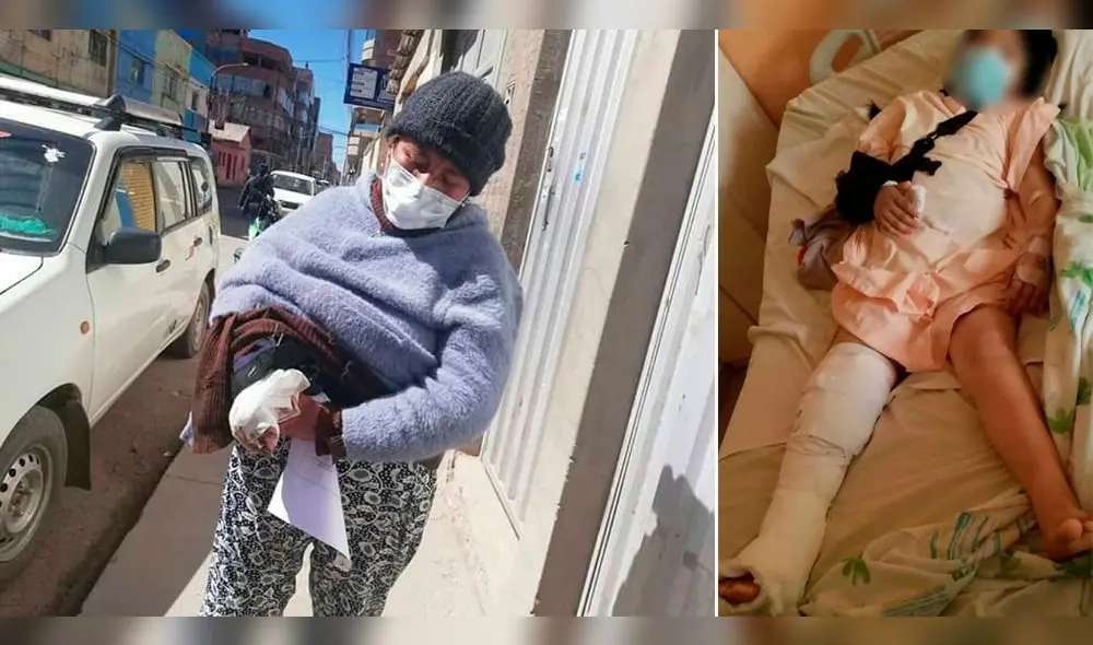 Ambas resultaron heridas en accidente de tránsito, la niña se llevó la peor parte. Ambas resultaron heridas en accidente de tránsito, la niña se llevó la peor parte.