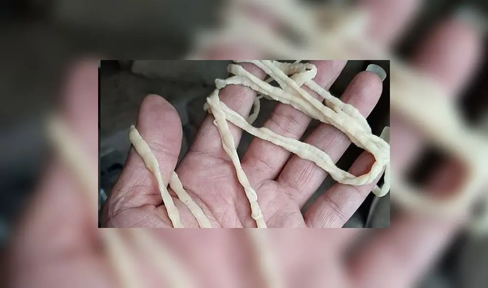 Un tailandés horrorizado tras expulsar una tenia gigante. Foto: Facebook. Un tailandés horrorizado tras expulsar una tenia gigante. Foto: Facebook.