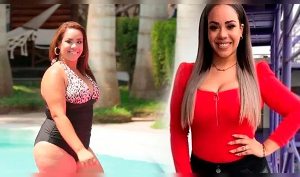 Antes y después de los famosos con popular cirugía del bypass gástrico 