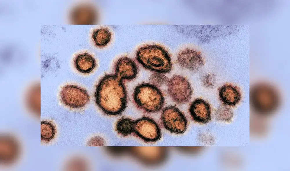 Partículas del coronavirus emergiendo de las células infectadas. Imagen de microscopio electrónico: NIAID.