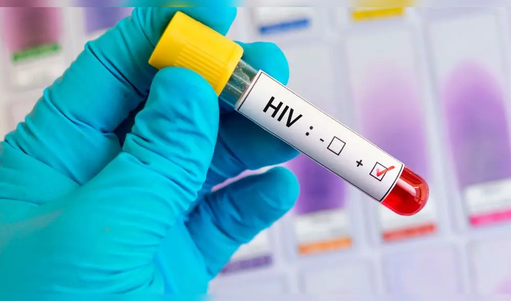 Salud México: pacientes de VIH y cáncer son grupos de riesgo ante la COVID-19 