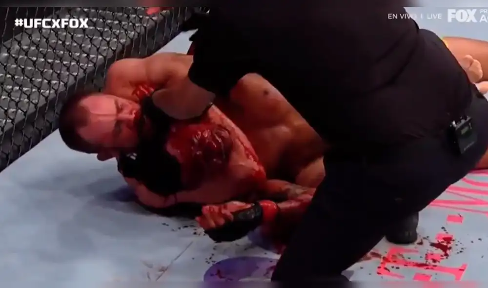 UFC 231: El codazo letal de Gunnar Nelson que bañó en sangre a 'Cowboy' Oliveira [VIDEO]