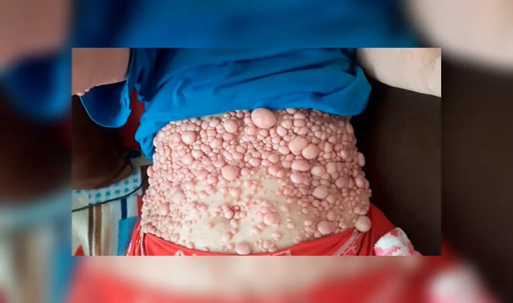 Mujer cubierta de más de 2.000 tumores revela que es abusada por extraños en la calle [FOTOS]