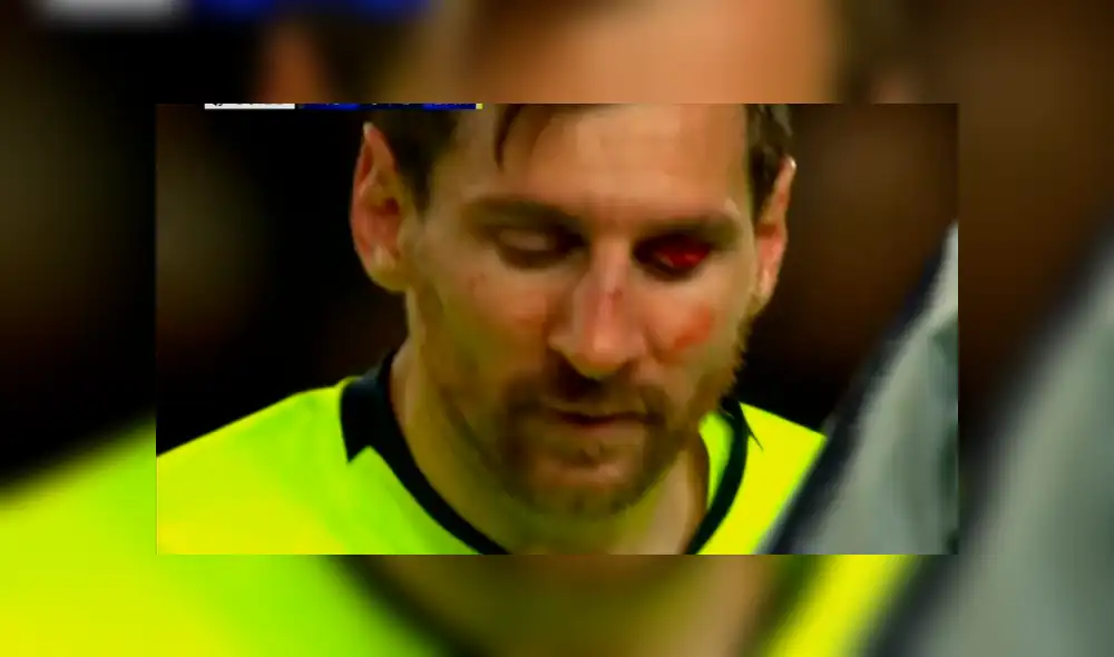 Barcelona vs Manchester United: Messi sufrió espeluznante corte tras duro choque
