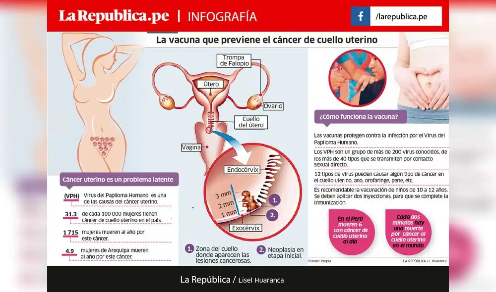 Vacunarán a escolares mujeres contra cáncer de cuello uterino [INFO]