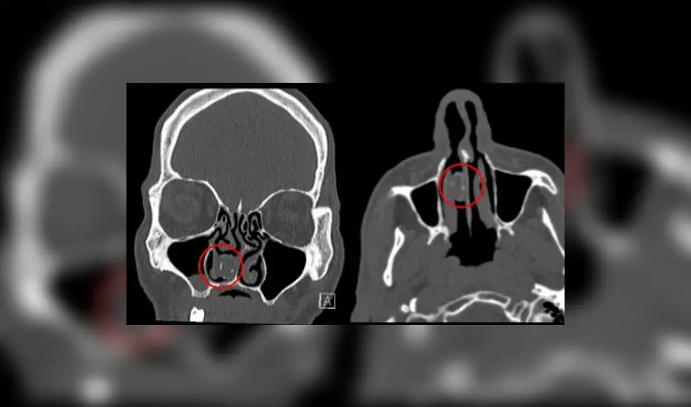 El recluso había tratado de pasar de contrabando la droga a los guardias de la prisión. Foto: Difusión. El recluso había tratado de pasar de contrabando la droga a los guardias de la prisión. Foto: Difusión.