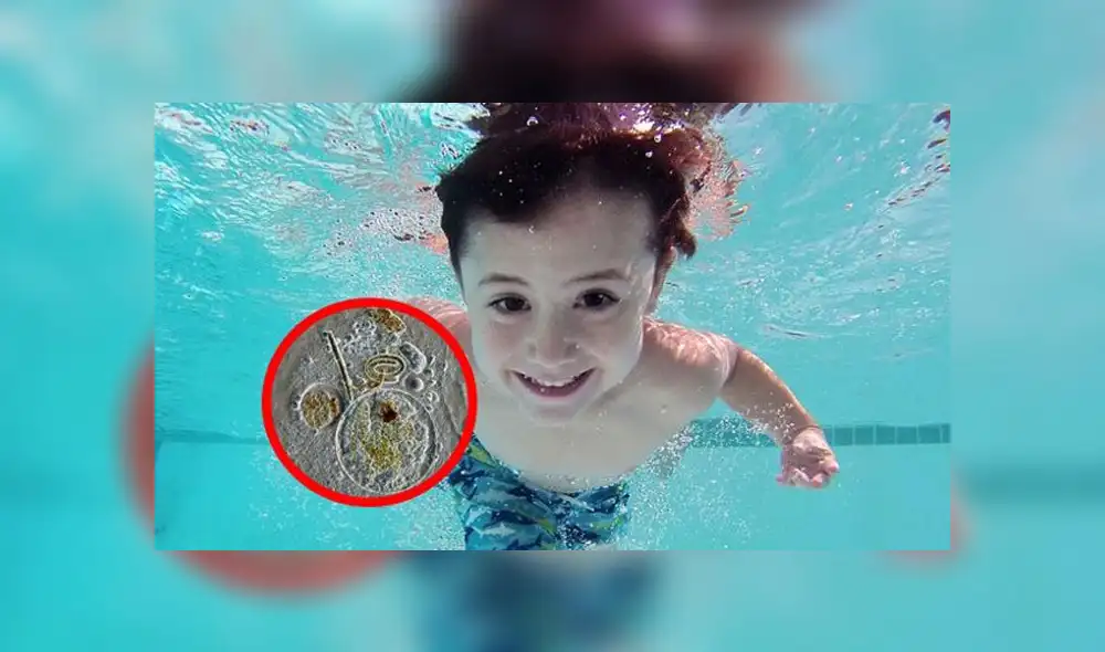 Todo lo que debes saber de la ameba ‘come cerebro’