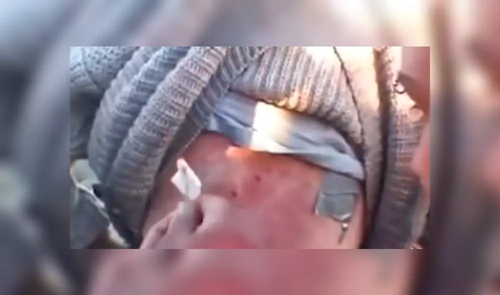 Facebook viral: misteriosas criaturas vivían dentro de la espalda de un joven sin que él lo sepa [VIDEO]