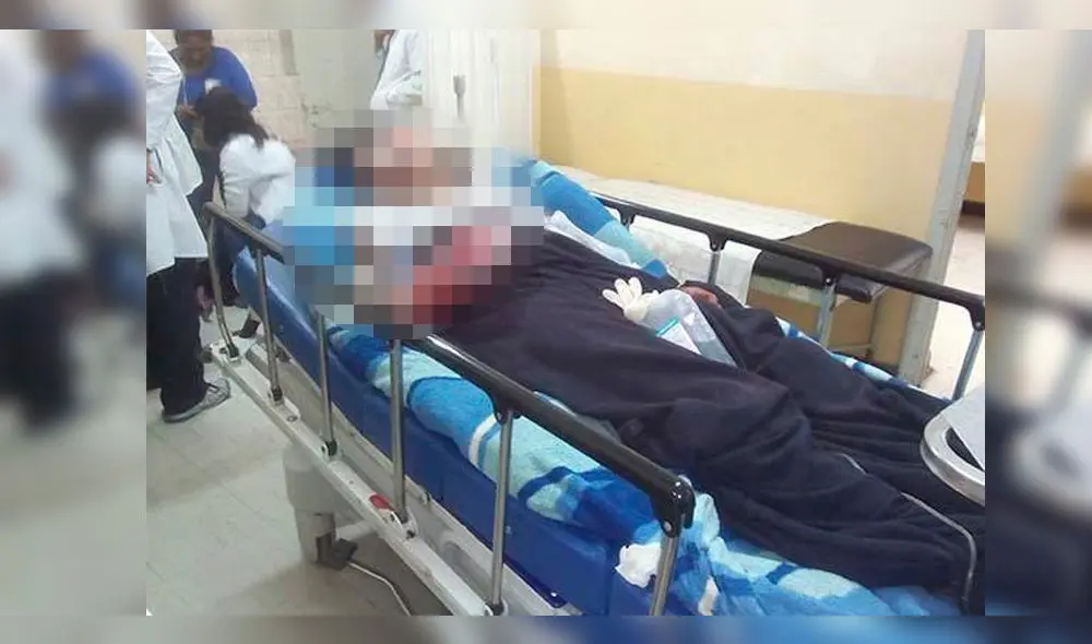 Foto referencial. Ebrio pierde la mano tras explosión de dinamita en Cusco