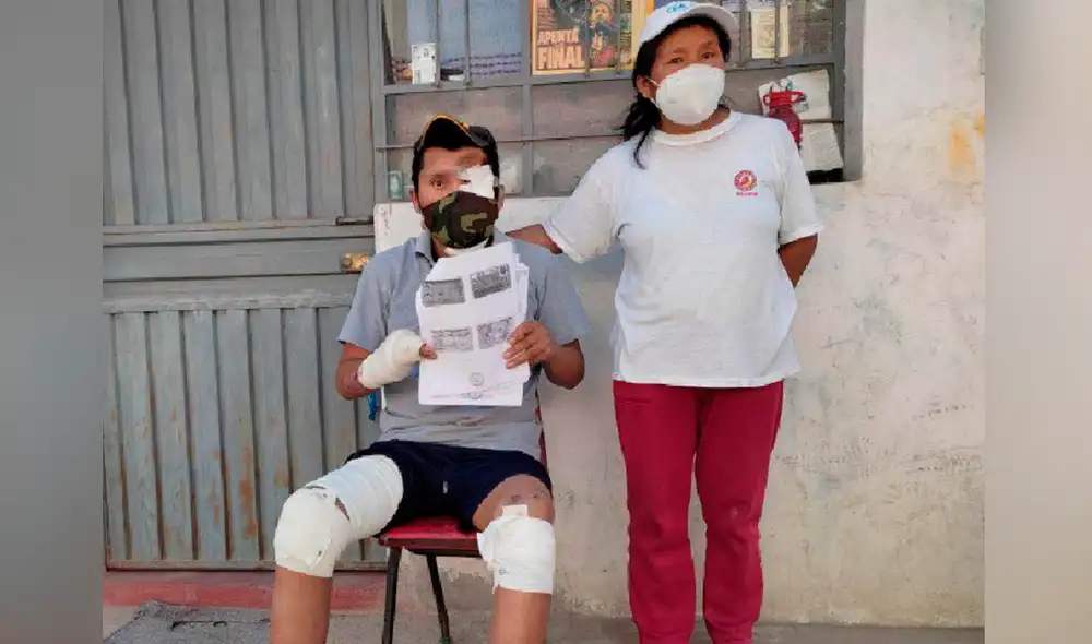 Heladero que fue atropellado por combi en Arequipa: “mis heridas siguen sangrando” Heladero que fue atropellado por combi en Arequipa: “mis heridas siguen sangrando”
