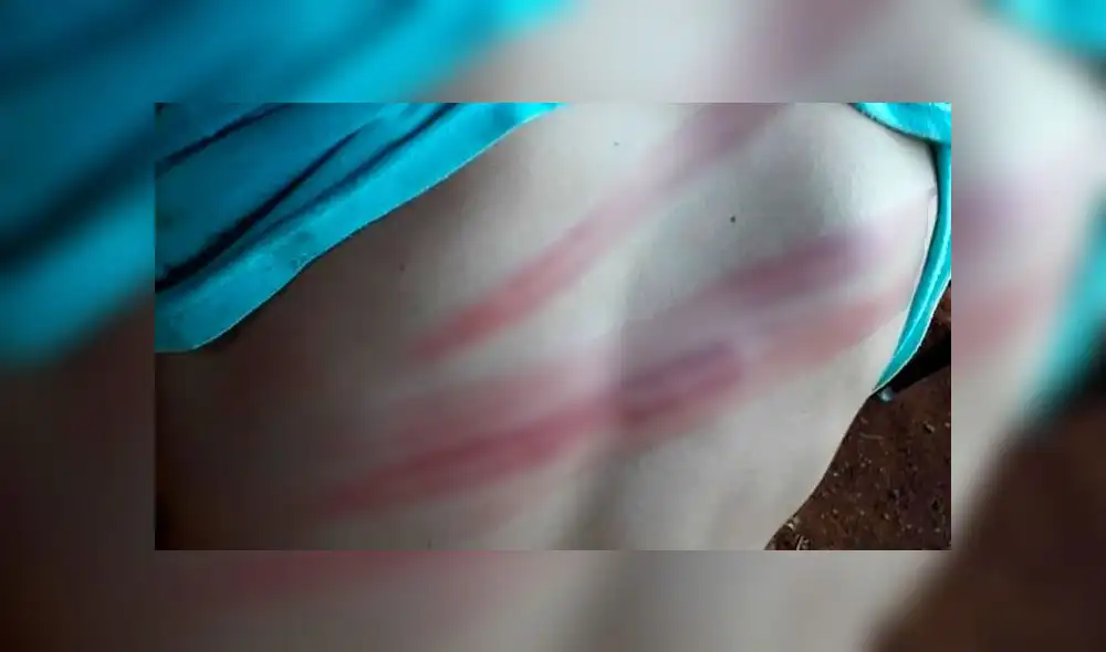 La agresión fue denunciada por las redes sociales. (Fuente: Facebook) La agresión fue denunciada por las redes sociales. (Fuente: Facebook)