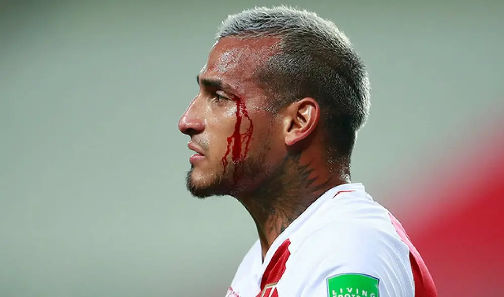 Miguel Trauco terminó con la ceja rota. Foto: ESPN