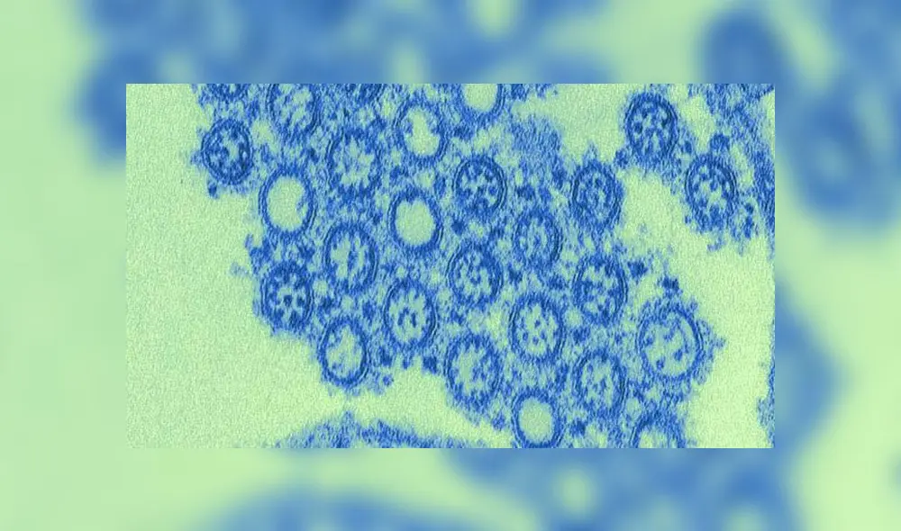 Muestra aislada del virus H1N1, causante de la pandemia de gripe porcina de 2009. Crédito: CDC.