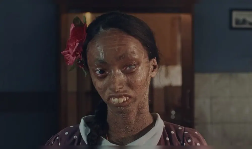 Nisha sufre de una de las afecciones cutáneas más raras del mundo. Foto: Captura.