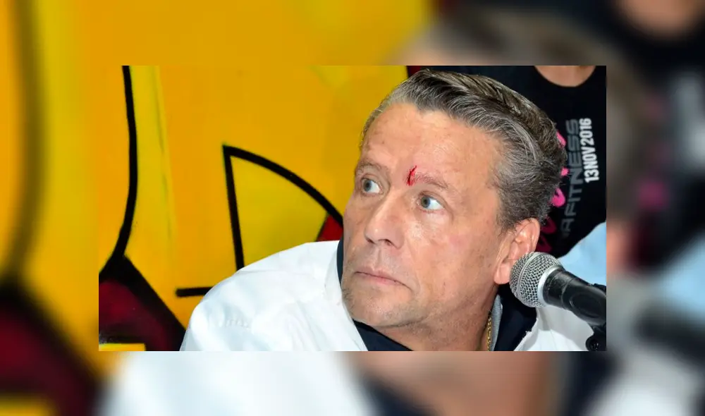 El actor fue atacado con una botella por Carlos Trejo. Foto: Difusión